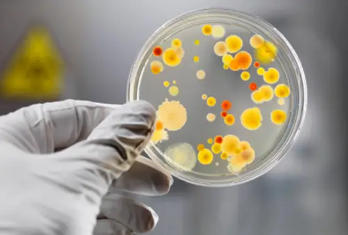 What Are Culture Plates?